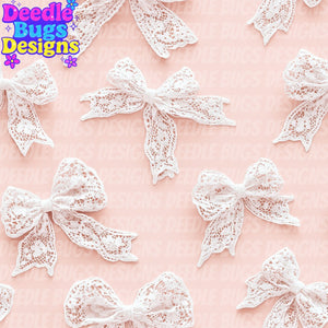 Lace Bows
